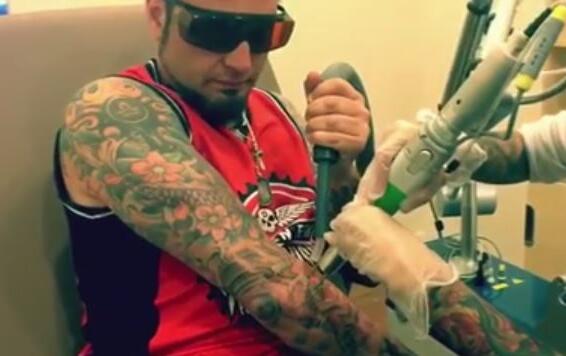 Video: FIVE FINGER DEATH PUNCH&#039;s JASON HOOK Gets Tattoo Removed At JEREMY SPENCER&#039;s New Business